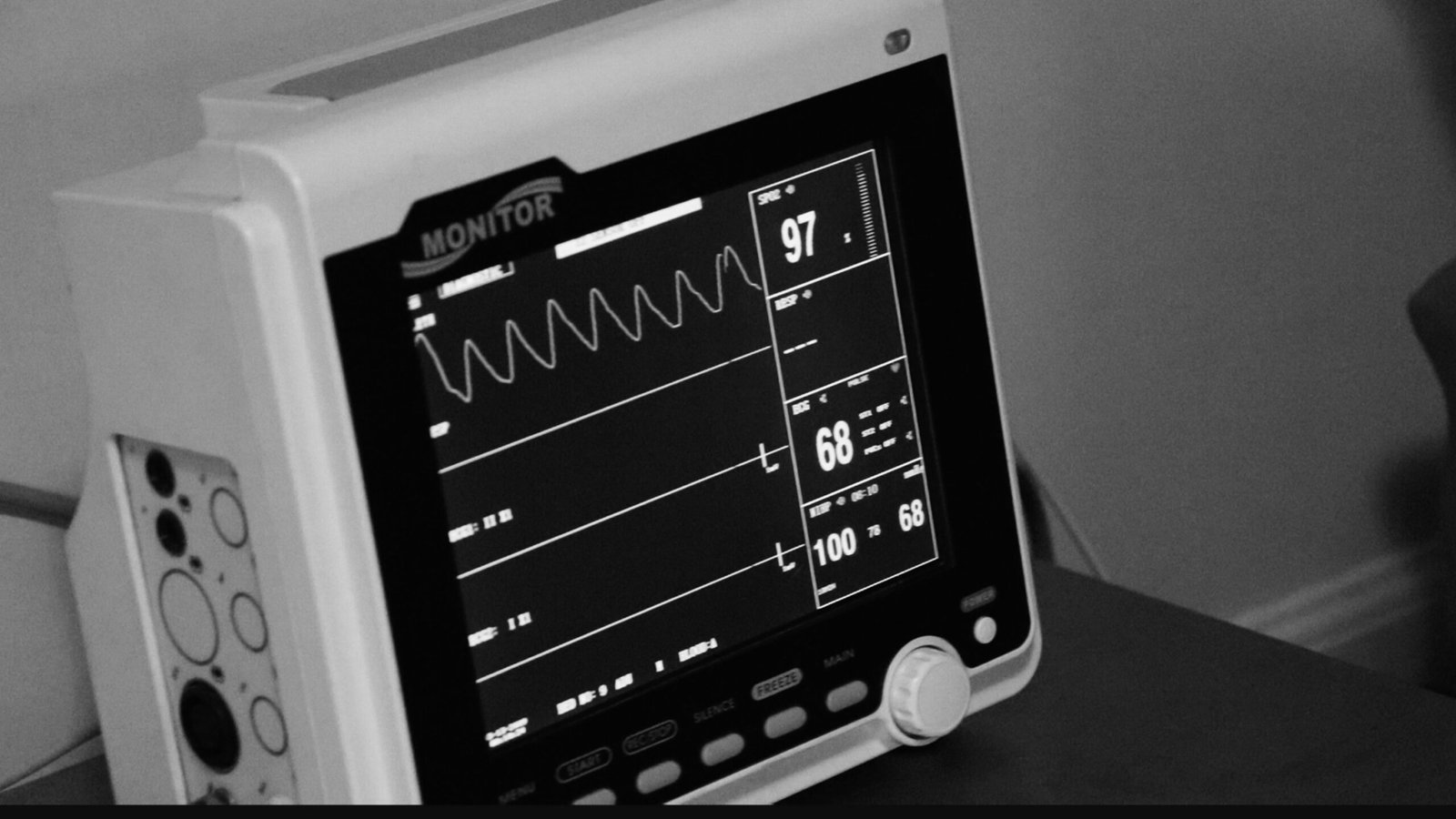 Discrepancies in 2-day exercise studies - ME/CFS Science